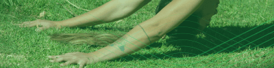 Image related to Primary Knee Arthroplasty
